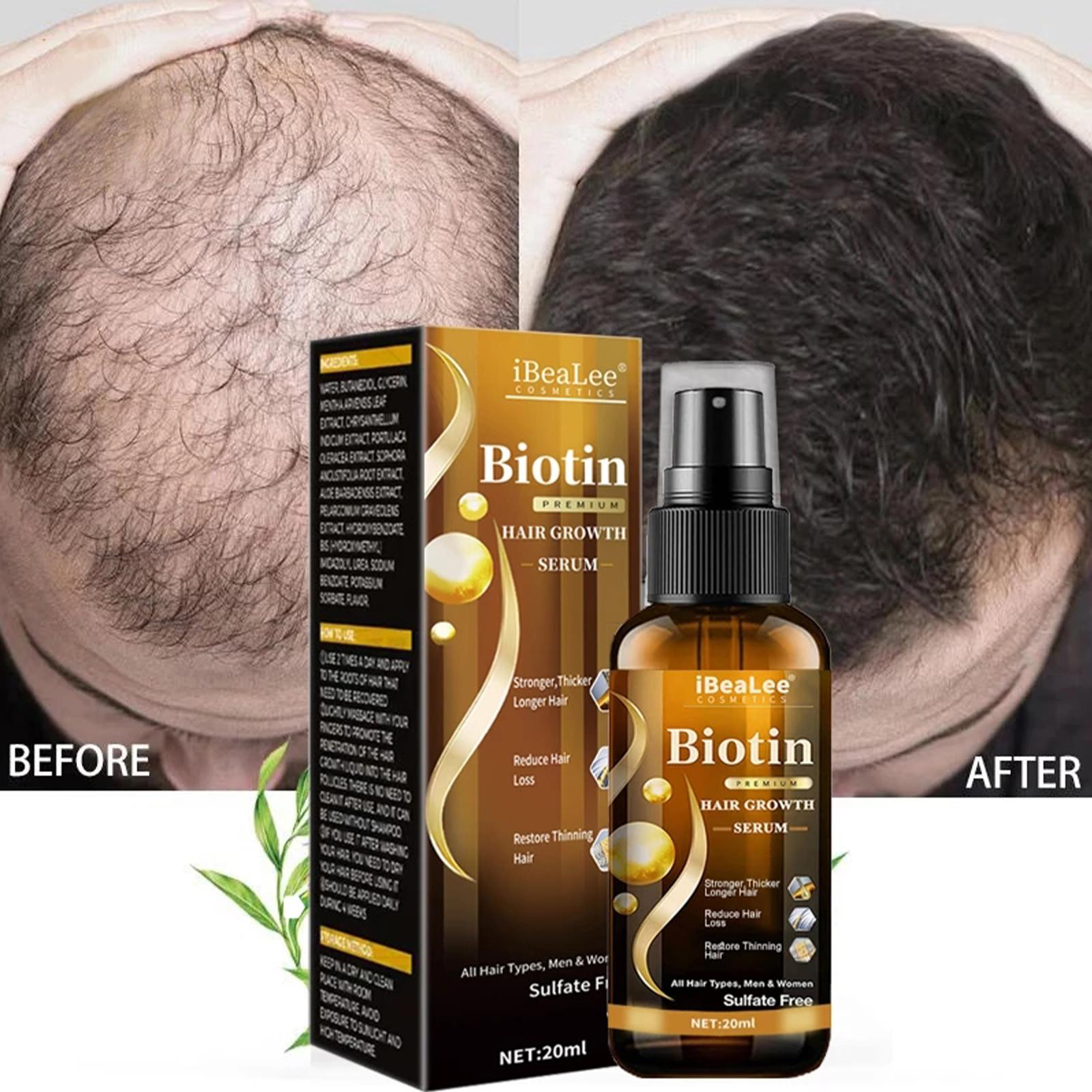 RootRevive Hair Therapy